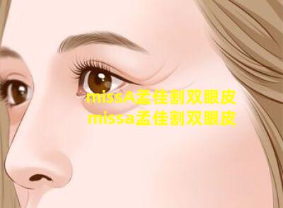 missA孟佳割双眼皮 missa孟佳割双眼皮